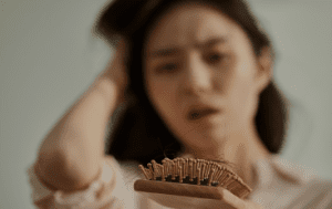 비오틴효능